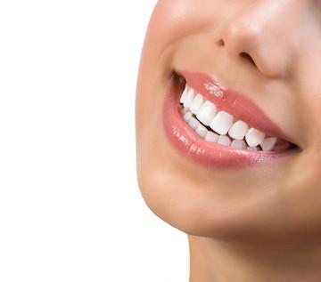 Close up of woman's bright, white smile after treatment in northborough