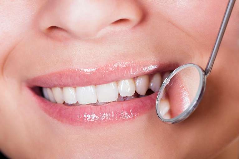 A woman smiling with Dental Crown in Northborough, MA