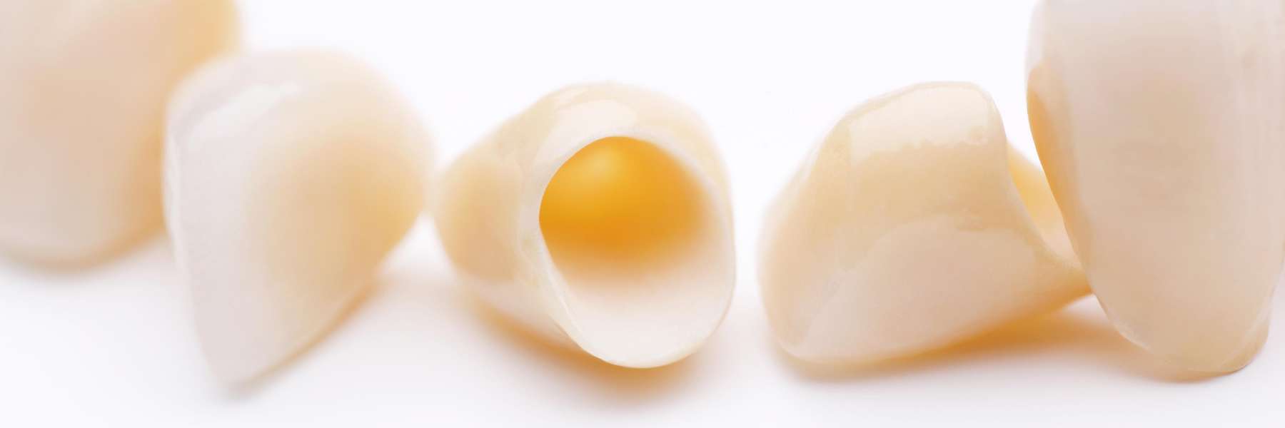 Samples of Porcelain Crowns in Northborough, MA