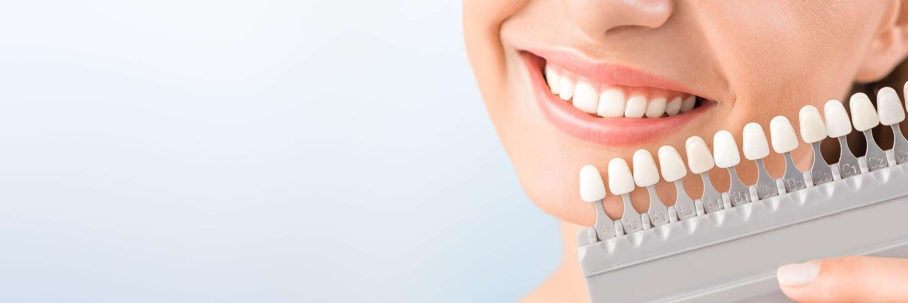 Teeth whitening shade guide held by a lady in Northborough MA