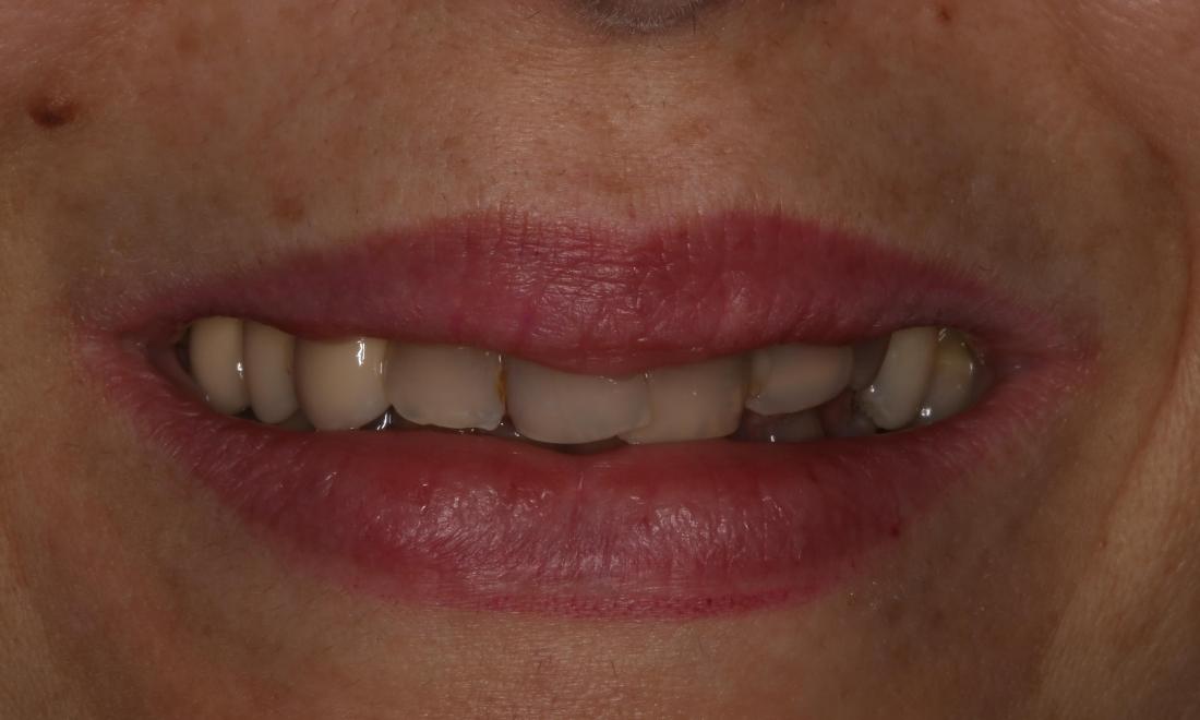 Close up of woman's smile
