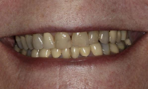 Close up of woman's yellow smile 