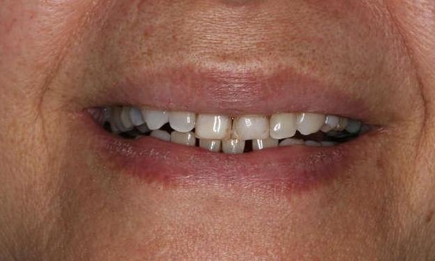 Close up of northborough woman's smile